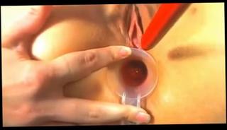 Watch the video about Check Her Self And Rectal Temp With Suppository