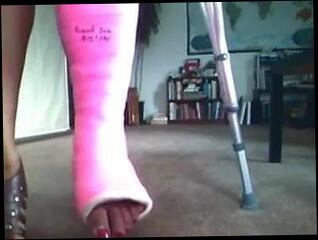 Video 208243501: foot fetish, fetish straight, broken foot, cast fetish