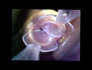 Video 359019001: cock urethra, gay man cock, inside urethra, cock exploring