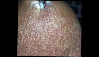 Video 174778295: solo close cock, penis solo, solo boy, dick solo, solo sounding, insertion solo, cock urethra