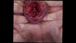 Video 1662850055: solo anal dildo masturbation, anal dildos gape huge, dildos big anal gape, solo anal dildo play, dildo big ass gaping, solo dildo slut, dildo solo boy, solo homemade dildo, solo amateur dildoing, solo male dildo, anal gaping whore, anal gape destroyed, anal gape queen, anal prolapse, guy anal dildo, prolapse training