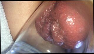 Video 797937203: fetish pump, solo pumped, anal pump toy, pumped anal fucked, pumped ass fucked, amateur anal fetish, solo male anal, pump close