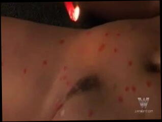 Video 1285901: bdsm hot wax, mistress punishes, hot wax ass, master punishes, extremely hardcore bdsm, straight bdsm, hottest bdsm, bdsm mature