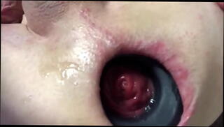 Video 1511439325: gay foot fetish sex, foot fetish gay masturbation, anal gape prolapse, gaping prolapsed ass, anal prolapse pump, anal pump vacuum, butt plug gape, anal gape compilation, gaping ass farting, nasty foot fetish, foot fetish dirty, orgasm foot fetish, foot fetish toy, foot fetish cum, foot fetish cumshot, foot fetish cock, foot fetish big, gaping open ass, big cock swinging