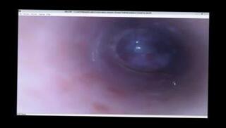 Video 180358701: cock urethra, gay man cock, gay man sounding, inside urethra, cock stuffed