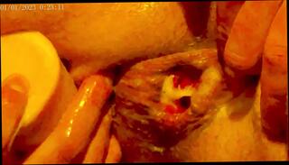 Video 1653431881: prolapse anal creampie, anal fisting prolapse, gay anal creampie, prolapse masturbation, anal creampie hd, french creampie