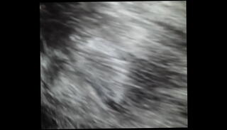 Video 240346935: dick nasty, nasty dick sucking, sucking dick blowjob