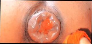 Video 1647984221: anal prolapse pump, fetish gay solo, ass anal prolapse, homemade solo anal, guy solo ass, straight guy solo, prolapse close, mexican solo, latino solo, fetish hd, fucking delicious ass, fuck ass hand, ass fuck huge, ass fucking two