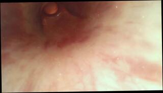 Video 1618085523: solo prostate, amateur orgasm solo, solo masturbation orgasm, male prostate orgasm, solo ejaculation, urethra orgasm, ejaculates inside, electric orgasm