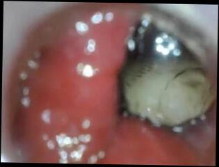 Video 269816401: doctor anal sex, doctor ass, doctor fist, doctor toys, doctor straight, doctor plays, doctor medical, anal toy inside