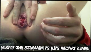 Video 1440131665: prostate massage fingering, anal fingering prostate, prostate massage masturbation, prostate massage gay, amateur prostate massage, anal fingering butt, fingering gay sex, ass fingering wet