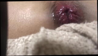 Video 1589284115: solo gay boy masturbates, boy solo anal, solo boy ass, solo amateur masturbation, prolapse masturbation, prolapsed butt, red prolapse