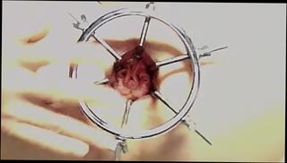 Video 1568422293: wide open, gaping anal dp, solo ass gape, anal gape fetish, fetish bdsm anal, fetish hardcore bdsm, fetish bdsm fucking, fetish gay solo, extreme bdsm fetish, gaping ass hole fucked, gaping ass hole toyed, gaping amateur ass, anal gape close, anal gape male, pulsating ass hole