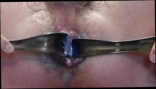 Video 1031493201: amateur anal gape, gay anal gape, gaping anal stretching, gaping anal hole, anal gape hd