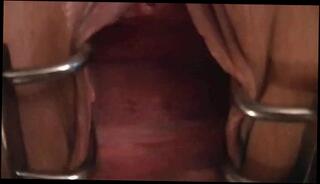 Video 88073601: pussy anal gaping, gaping anal toying, gaping anal sex, amateur anal gape, pussy clamps, clamped ass, clamped fucked, pussy gape close, anal sex straight, clit ass, ass fuck play, cum inside