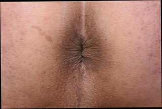 Video 1605225511: fetish gay solo, virgin solo, ass hole anal fetish, amateur virgin ass, fat ass solo, solo male ass, fetish guys ass, ass solo hd, fetish gay men, japanese gay solo, gay asian solo, fetish striptease, ass hole close