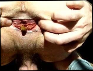 Video 45865901: gaping ass hole stretched, love gaping, gay man ass hole