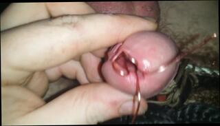 Video 167411601: wide open, bdsm sex toys, bdsm gay sex, amateur bdsm sex, speculum, man bdsm, urethra play, wide dick, dick hole