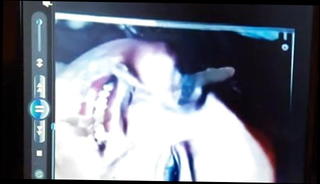 Video 1258498601: emma stone, cock double cum, double cumshot, double gay, hd double