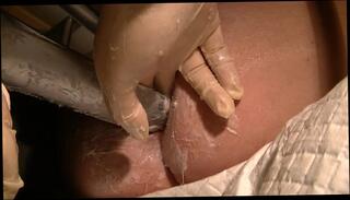 Video 202675501: bdsm fisting, speculum ass, gay bdsm, amateur bdsm, hd bdsm, spread ass hole