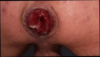 Video 1610612433: fetish twinks anal, gay twink fetish, twink solo gay, solo amateur twink, solo twink plays, young twink solo, hentai fetish, twink hardcore anal, extreme anal prolapse, solo male anal, gay twink french, gay twink old, prolapse close