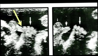 Video 1179023301: sex orgasm, orgasm straight, talk orgasm