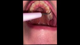 Video 1458980703: amateur fetish, open mouth fetish, cleaning fetish, fetish deep