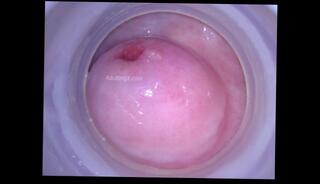 Video 1623468283: speculum pussy gape, solo pussy gape, giantess vore fetish, hardcore pussy gaping, amateur solo pussy, pussy gape close, gaping vagina, pussy solo female, vore shrink, speculum inside, vore fantasy, impregnation fetish, camera solo, pussy behind