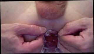 Video 132801401: fisting gape prolapse, prolapse gay, gaping man