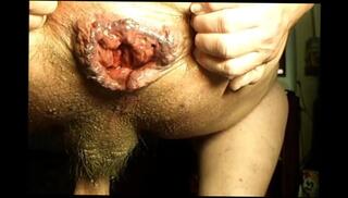 Video 283515601: anal sex ass gaping, gaping anal toying, ass big anal gapes, pussy anal gaping, amateur anal gape, gay anal gape