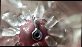 Video 1622595453: fetish creampie, creampie solo, hardcore pussy fuck creampie, toy sounding urethral fetish, cock sounding urethral fetish, creampie cum inside pussy, pussy fucking creampie close, amateur pussy creampie, pussy creampie cumshot, creamy pussy solo, creampie young pussy, solo male cum, creampie sperm, insertion creampie, old young creampie, creampie 60fps