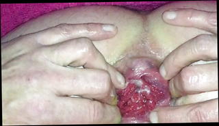 Video 1054789401: anal sex ass gaping, gaping anal toying, amateur anal gape, gay anal gape, gaping anal stretching, anal gape hd, stretching prolapse, arse stretching