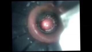 Video 116225901: toy gay man, toys cum, cumshot toys, toy inside