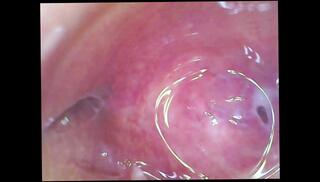 Video 1623231903: solo dildo masturbation orgasm, solo girl dildo masturbating, solo amateur dildoing, solo female dildo, big dildo solo, sperm dildo, solo masturbation inside, dildoing vagina, dildo camera, orgasm inside pussy, cam inside pussy, sperm juice