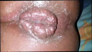 Video 1357815825: fetish ass fingering, big ass shemale creampie, big ass anal fingering, tranny fingers ass, ass fingering fisting, fingers ass toys, sex ass fingering, pumped ass big, black tranny creampie