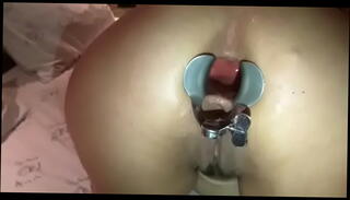 Video 932350705: fetish slut toys, fetish slut anal, fetish slut ass, butt fetish, big ass fetish, amateur fetish, medical fetish