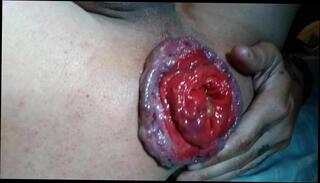 Video 362450601: gay gaping ass hole, gape hd, ass hole destroyed