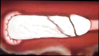 Video 1181904501: anime anal, straight anal