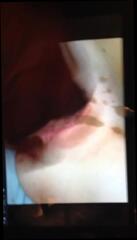 Video 200726401: huge cum load pussy, gay man cum