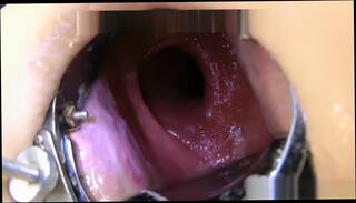 Video 757998804: solo webcam toying, anal webcam solo, amateur webcam solo, webcam solo female, solo webcam hd, inserts speculum, speculum deep, sexy deep